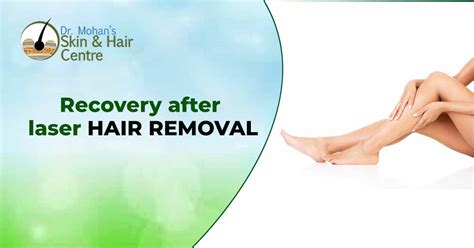 Recovery After Laser Hair Removal
