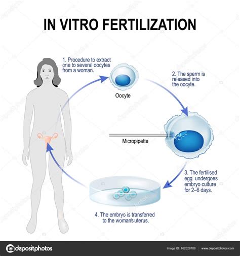 in vitro fertilisation stock vector image by ©edesignua 162328708