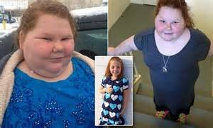 obese texas girl alexis shapiro loses 6lbs and off insulin after