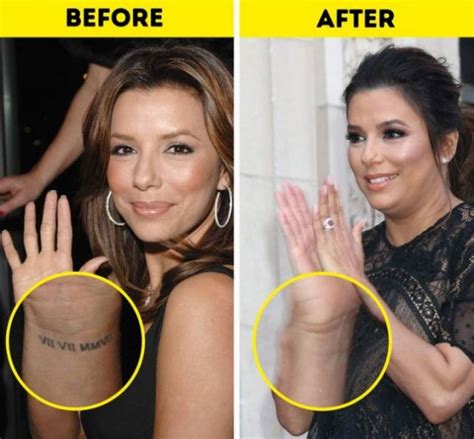 Celebrities Who Had Their Tattoos Removed 12 Pics