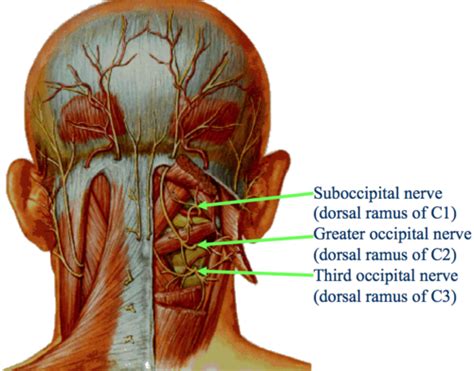 pin  los guaduales  knowing  body occipital nerve block nerve