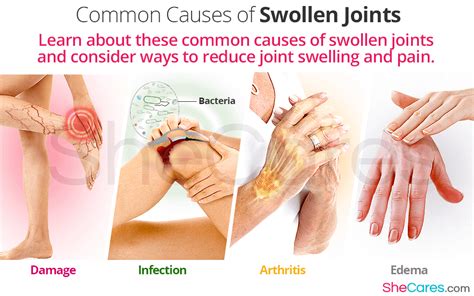 Joint Swelling Causes And Solutions Shecares