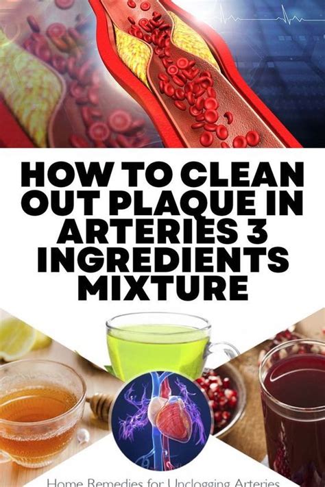 how to clean out plaque in arteries 3 ingredients mixture in 2023