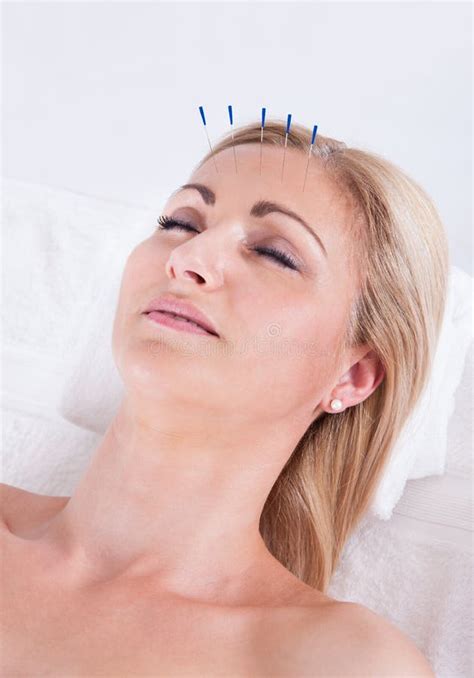 acupuncture therapy   spa center stock image image  care