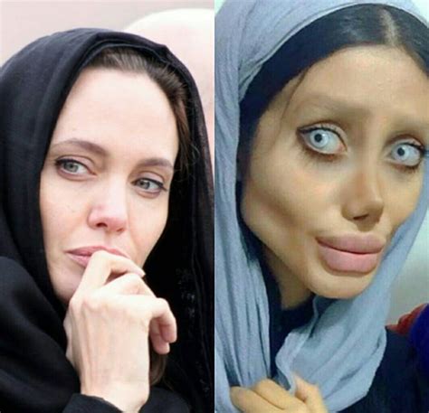 Woman Undergoes 50 Surgeries To Look Like Angelina Jolie See The