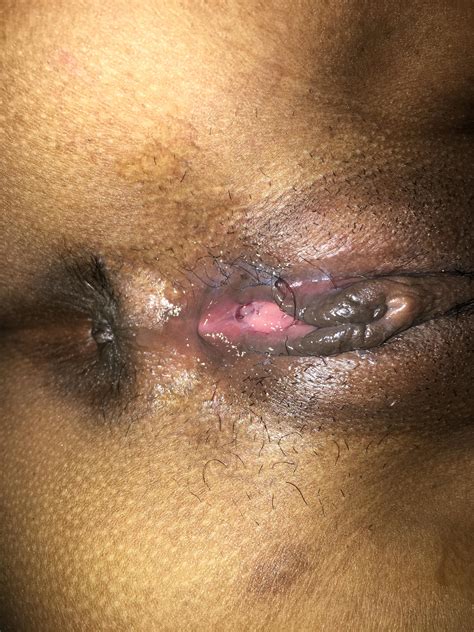 closeup of my pussy lips [f] porn pic eporner
