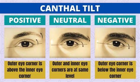 canthal tilt affect  face attractiveness