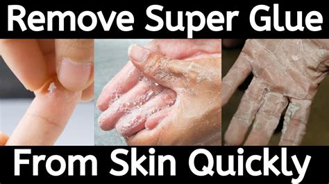 remove super glue  skin    super glue  skin