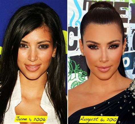 kim kardashian boob job butt plastic surgery before and