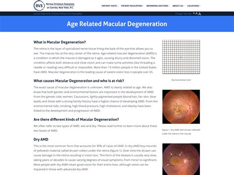 age related macular degeneration retina vitreous surgeons  cny