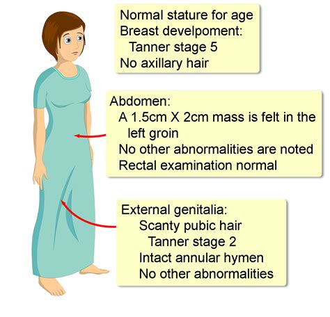 complete androgen insensitivity syndrome  symptoms treatment