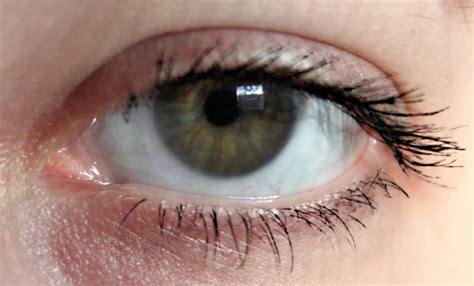 10 Of The Most Common Eye Problems In The World