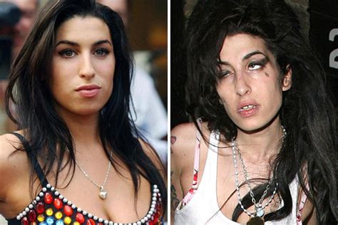 20 shocking photos of celebs before and after drugs 1 will knock you out — theinfong