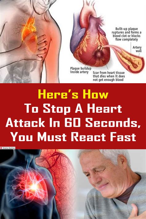 heres   stop  heart attack   seconds   react fast therapy healt