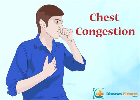 rid  chest congestion  symptoms healthmd