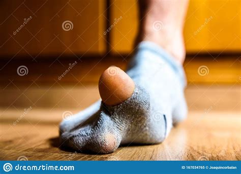 broken sock with a hole in a man`s big toe concept of