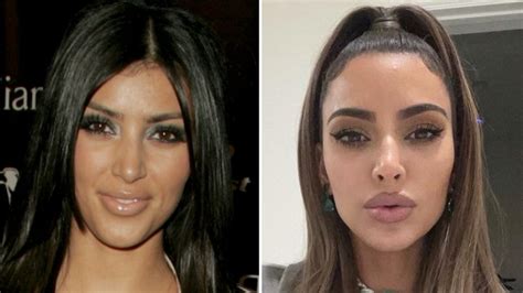 kardashian plastic surgery timeline kim kardashian s plastic surgery