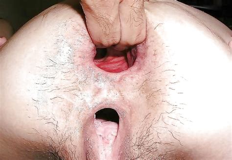 Big Pussy Lips Labia Mature Sluts 27 Pics Xhamster