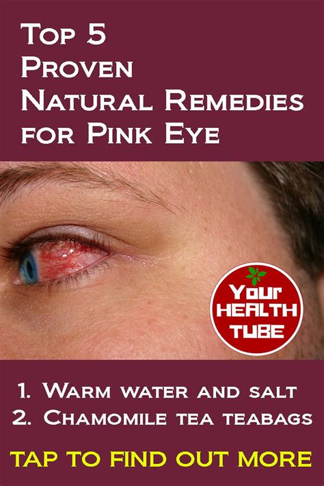 herbs eye health natural pink eye remedy natural remedies