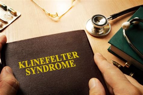 Famous People With Klinefelter Syndrome Std Gov Blog