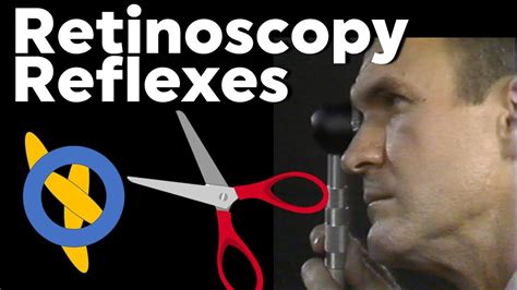 Scissor Reflex Retinoscopy Problems Keratoconus Spherical Aberration