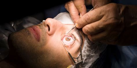 is lasik eye surgery safe lasik eye surgery side effects and risks