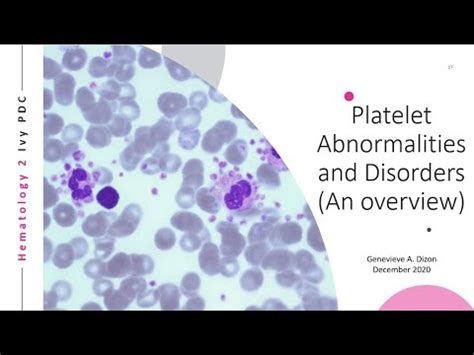 platelet abnormalities  disorders youtube