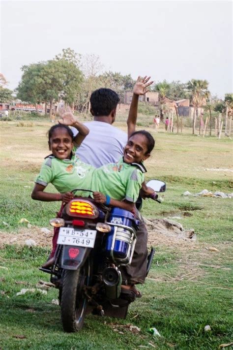 Conjoined Twins From India Fell In Love For The First Time