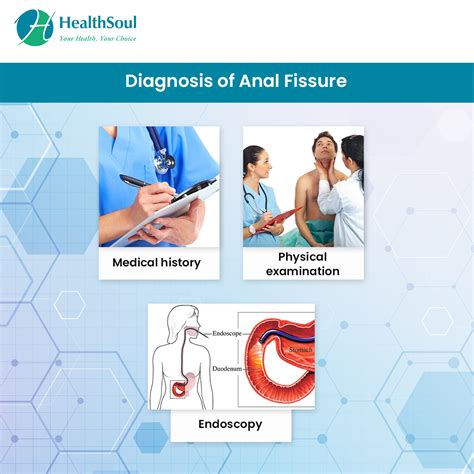 Anal Fissure Symptoms Diagnosis And Treatment Healthsoul
