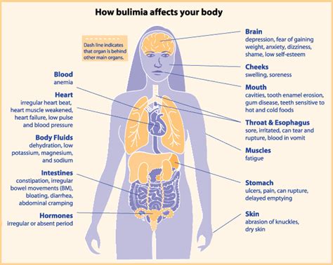 effects of eating disorders