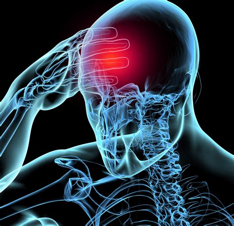 concussion symptoms  risk factors  complications