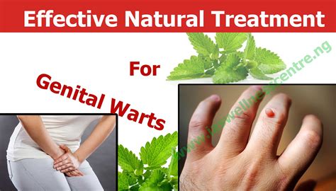 effective natural treatment for genital warts in nigeria i a s