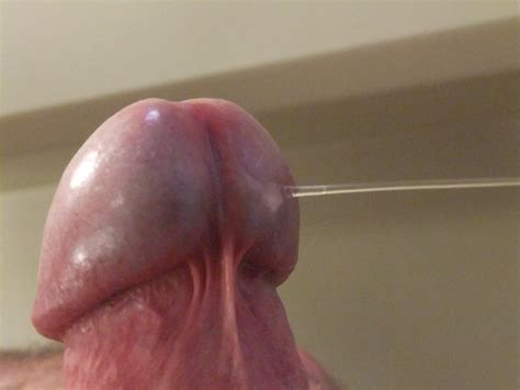 close up penis head glans cum