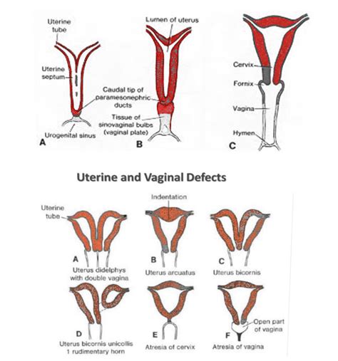 [figure Uterus Embryology Image Courtesy O Chaigasame] Statpearls