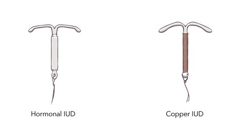 iud birth control info about mirena and paragard iuds
