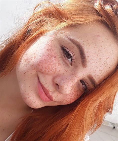 Ruivindades Photo With Images Beautiful Freckles Freckles Girl