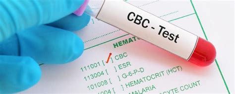 complete blood count cbc test blog trivitron healthcare solutions medical