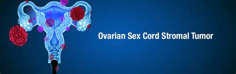 Ovarian Sex Cord Stromal Tumors Diagnosis Treatment Free Download
