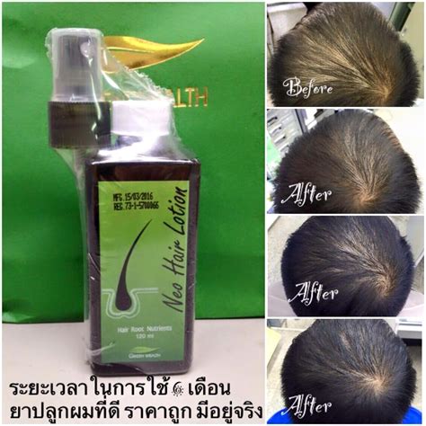 Neo Hair Lotion By Green Wealth Thailand Best Selling
