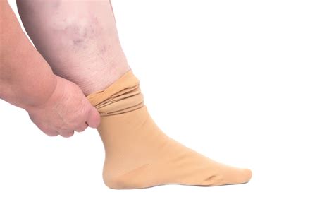 compression stockings for swollen feet south jersey podiatrist