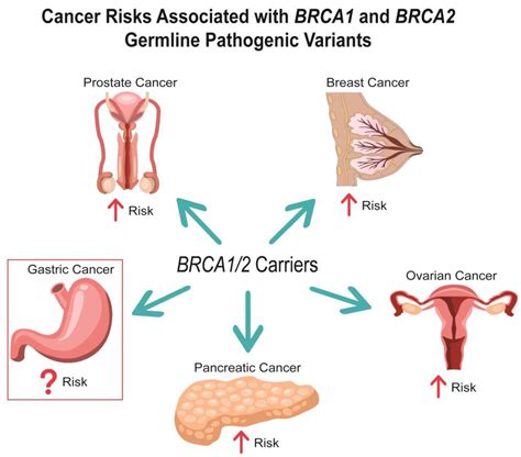 cancers  full text gastric cancer risk  pathogenesis