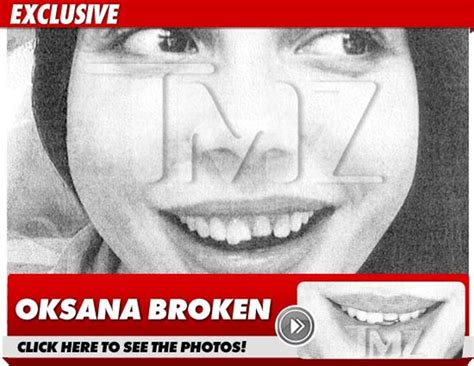 oksana teeth photo dental pictures from oksana the morning after