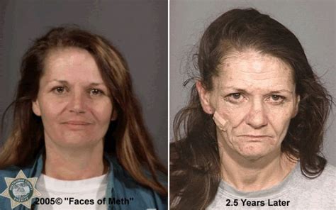 Photos Faces Show Horrors Of Meth Abuse Upper Macungie Pa Patch