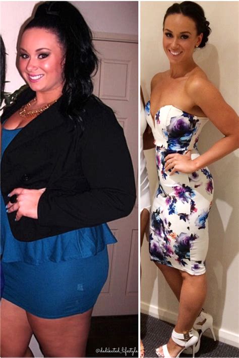 Kate Writer Lost Over 50kgs In A Year To Completely