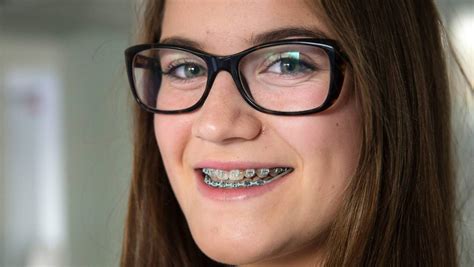 Brace Yourself Those Teeth Will Cost A Lot To Fix Nz