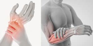hand upper limb injuriesconditions stratford hand therapy