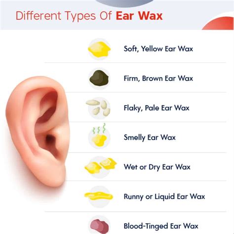 ear shapes