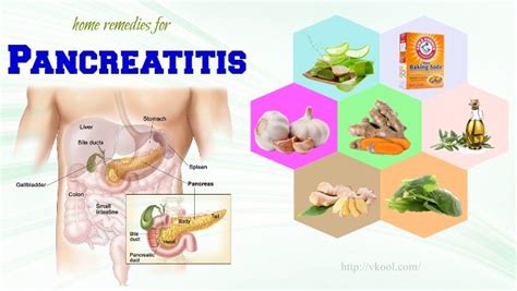 17 Home Remedies For Pancreatitis Pain And Symptoms