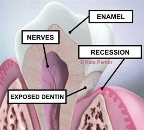 natural tooth pain remedies remedygrove