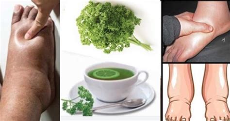 natural remedies for swollen ankles legs and feet parsley tea recipe